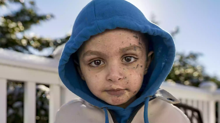 4-year-old in Gaza getting a second chance