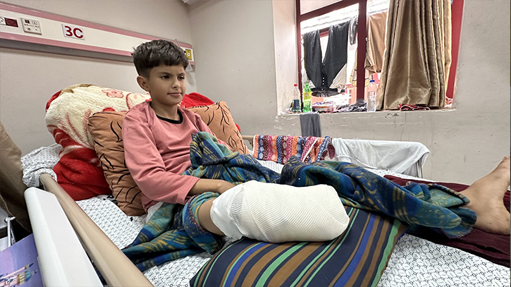 10 children lose leg per day in Gaza