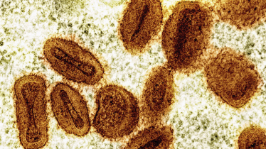 US health officials report 1st case of new form of mpox in a traveler