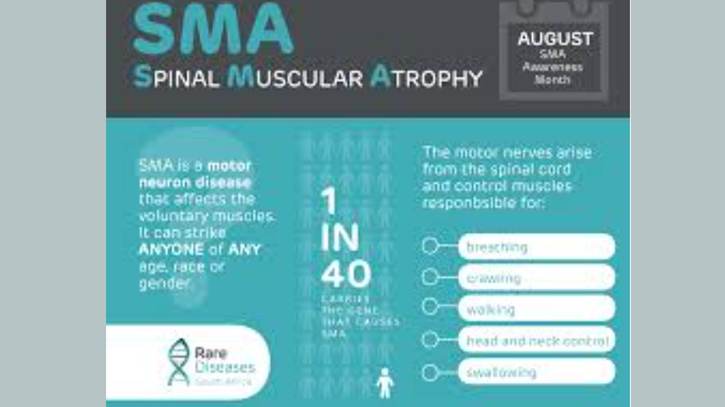 Hopes shine in the treatment of rare disease SMA in BD