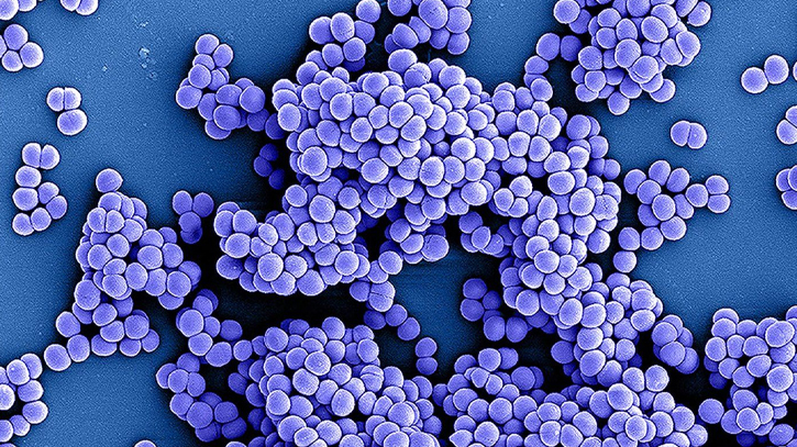 Drug-resistant superbugs projected to kill 39 million by 2050