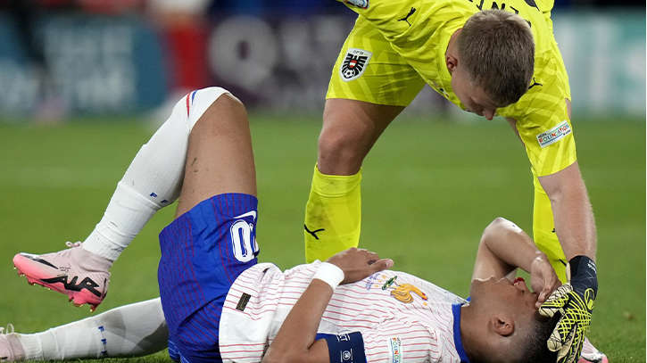 Mbappe`s Injury might directed France Plan B:Euro 2024